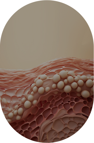 미세조직 손상 최소화